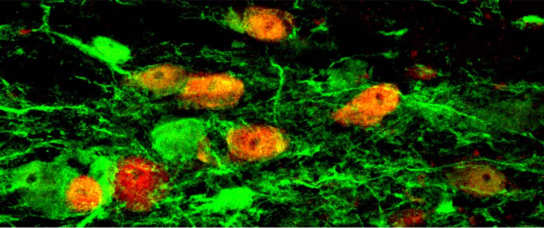 Using strict lineage tracing, UT Southwestern researchers showed that glial cells could be <em>in vivo</em> converted into functional mouse neurons (red). Image is from a previous study by the Chun-Li Zhang laboratory at UT Southwestern.